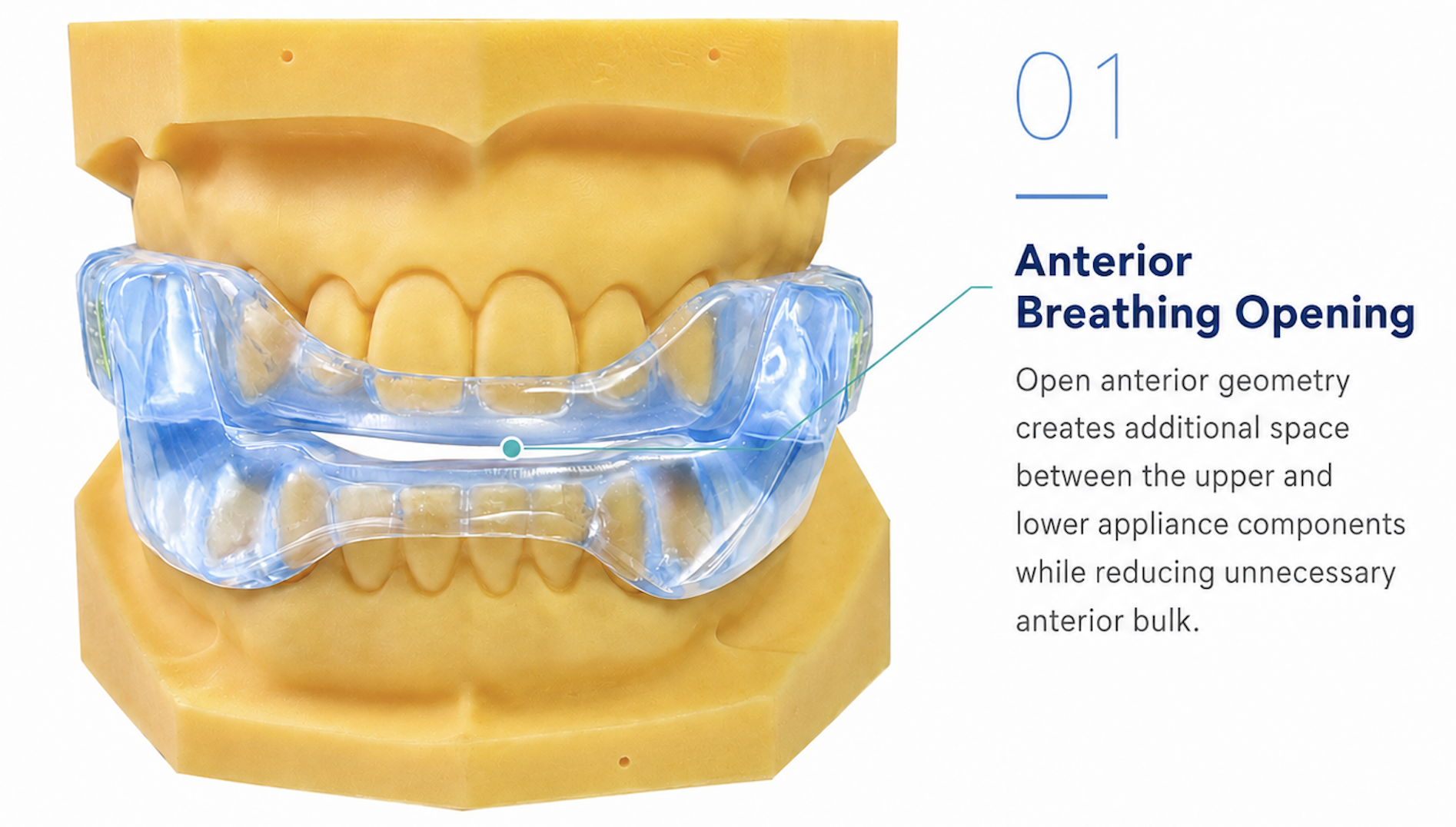 Master Sleep 20™ appliance — anterior breathing opening