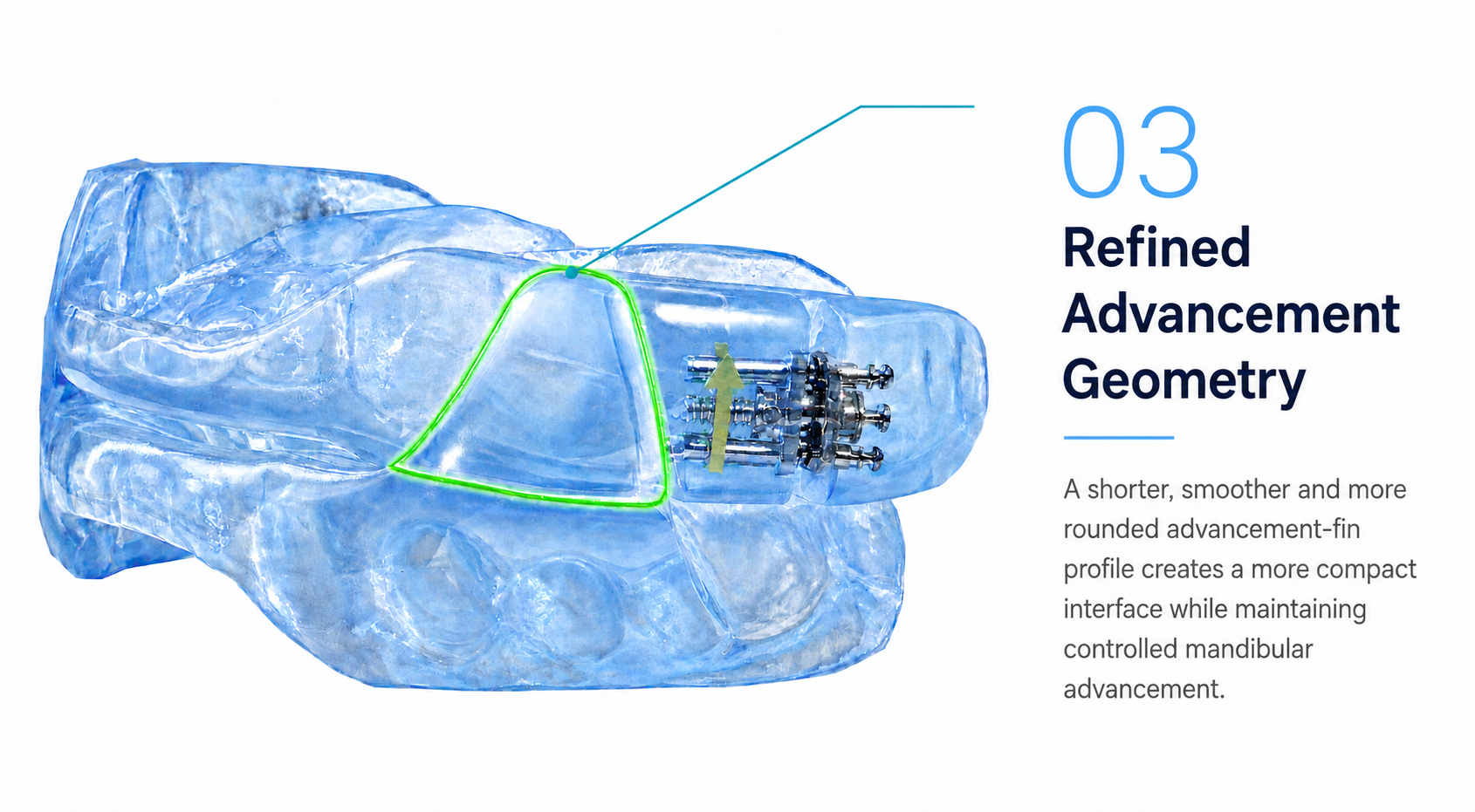 Master Sleep 20™ appliance — refined advancement geometry