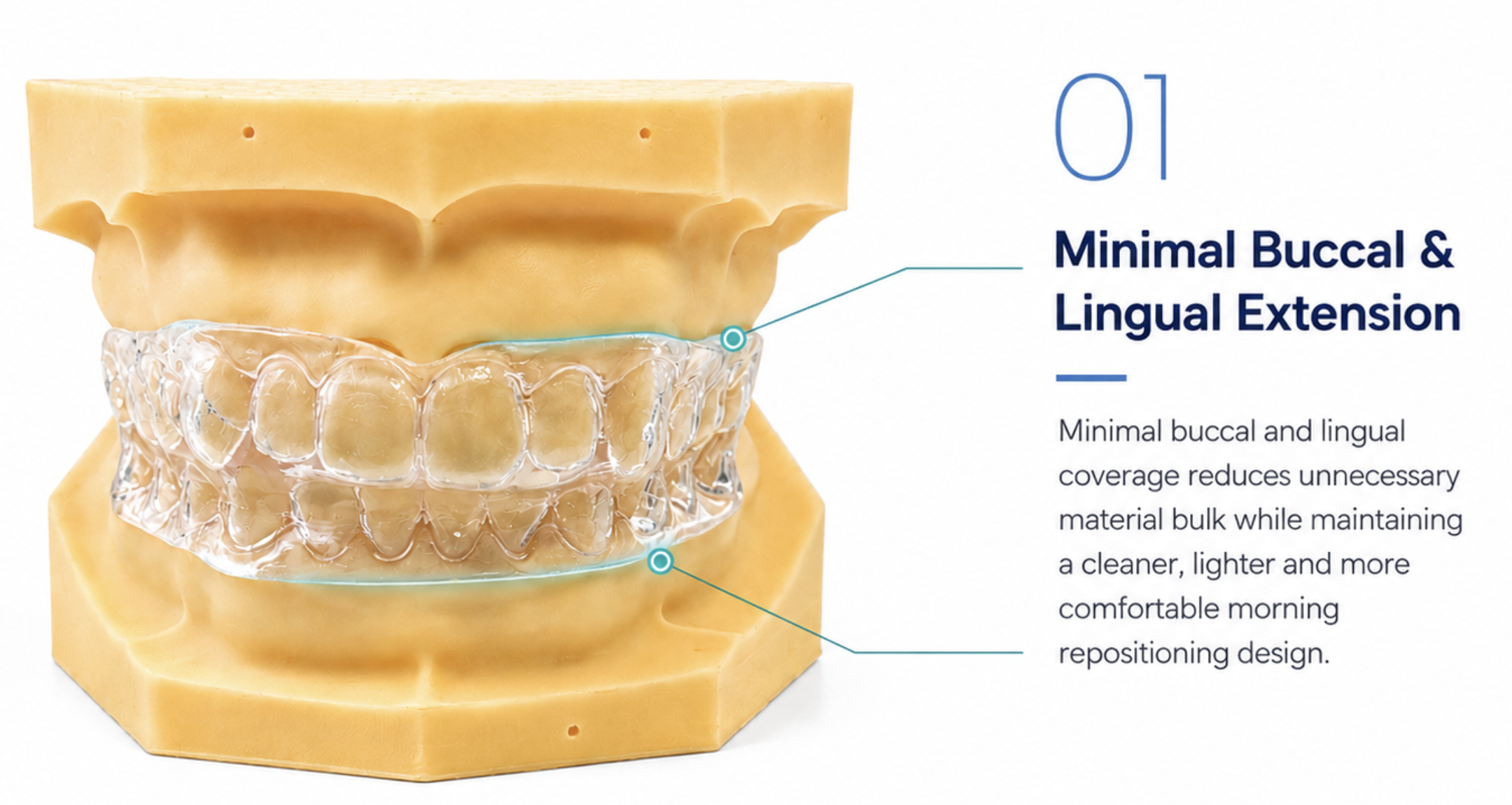 Master Sleep 20™ Morning Repositioner — minimal buccal and lingual extension