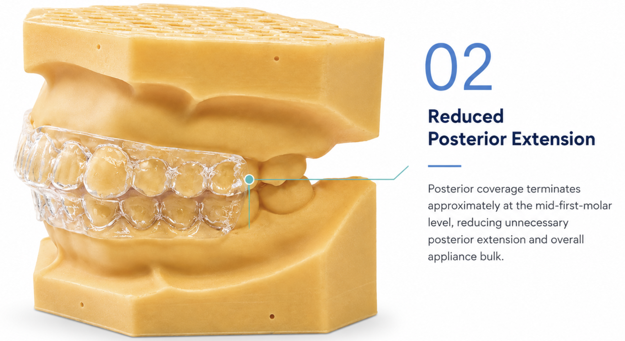 Master Sleep 20™ Morning Repositioner — reduced posterior extension