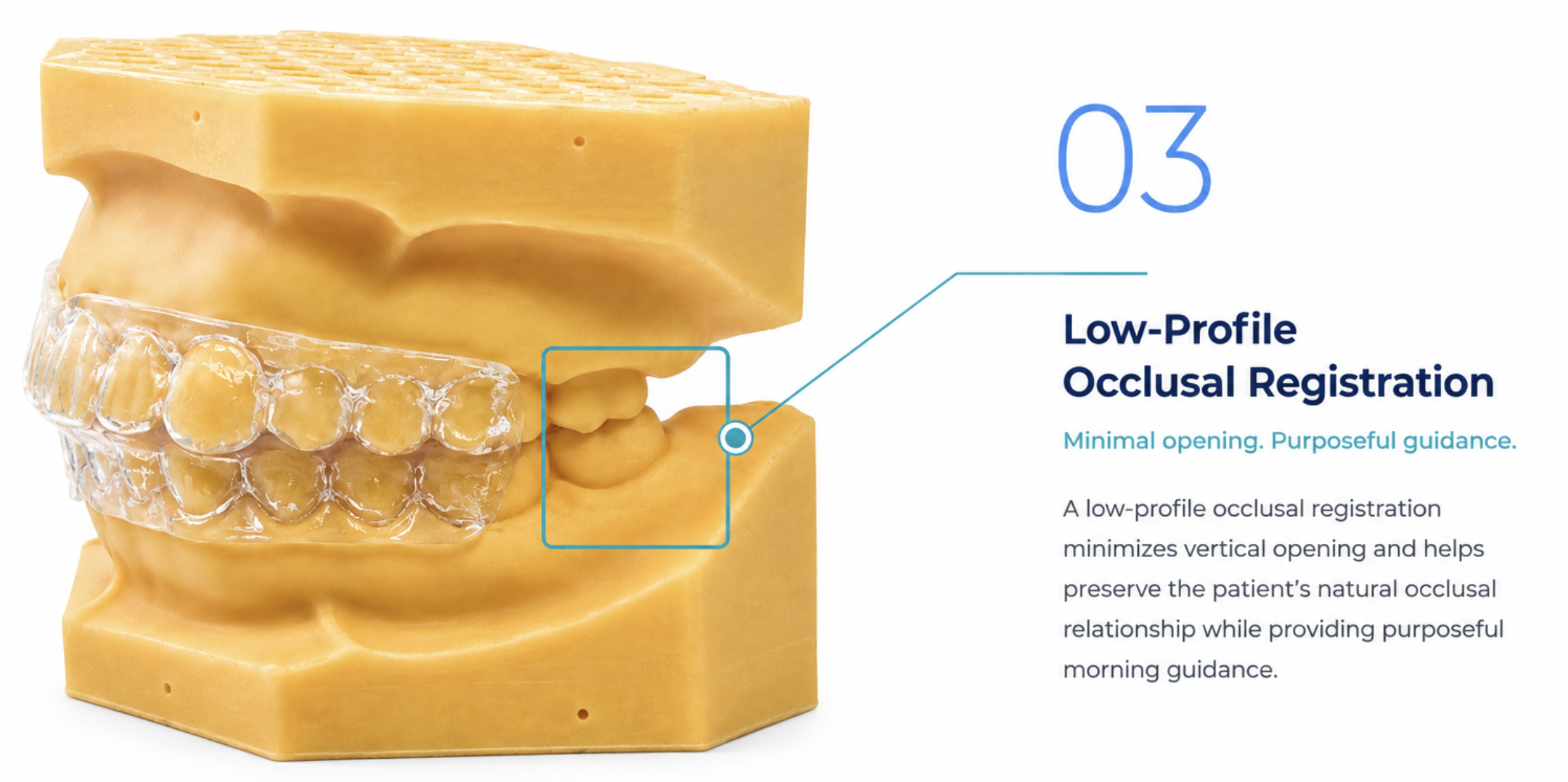 Master Sleep 20™ Morning Repositioner — low-profile occlusal registration